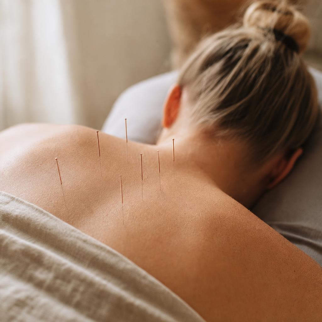 Acupuncture — Upper Back Meridian